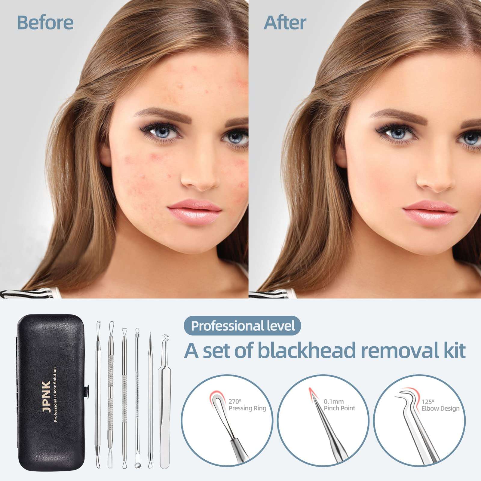 JPNK Blackhead Remover Comedone Extractor Acne Removal Kit.. - Image 2