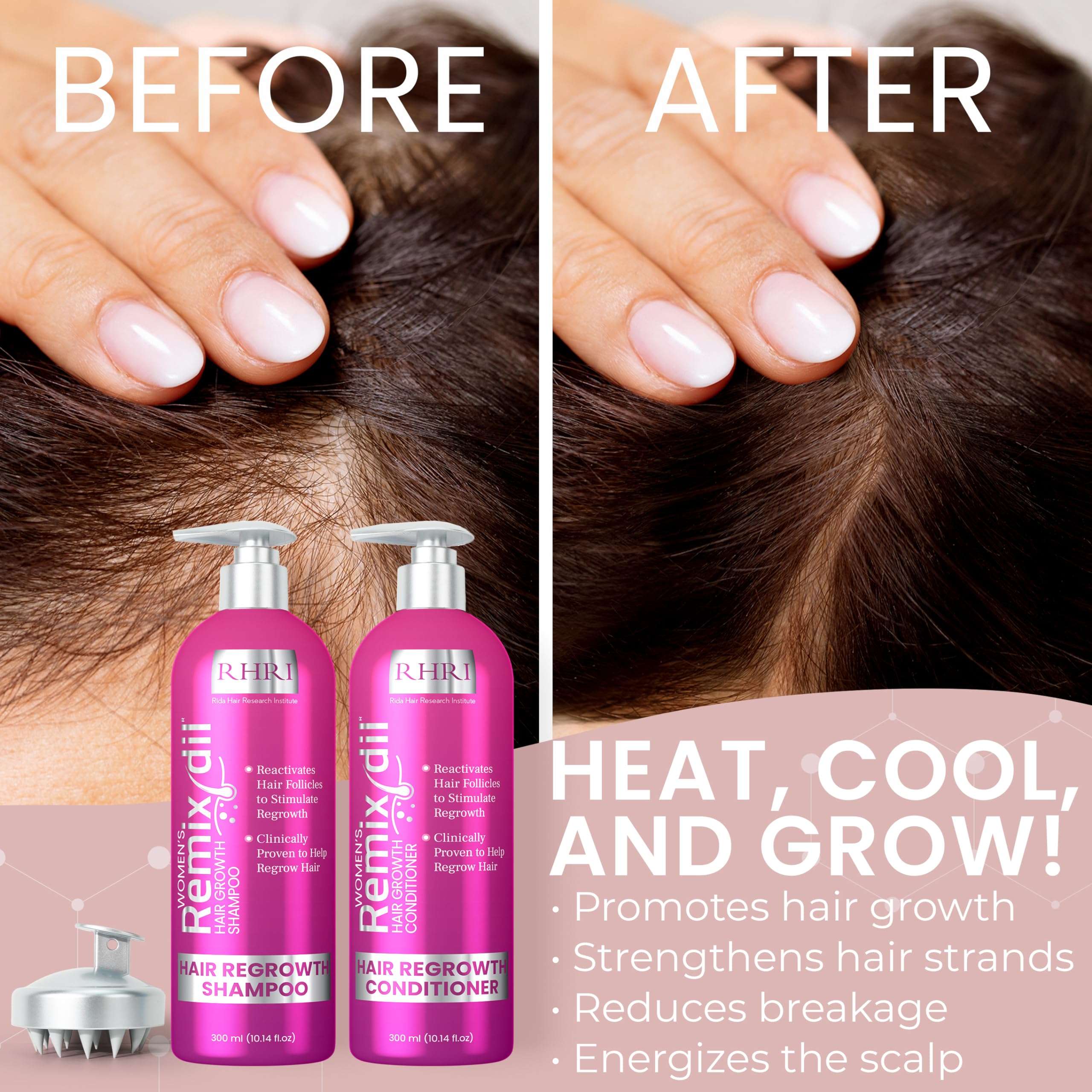 34 OZ Hair Growth Shampoo and Conditioner Set for Women | Effective Hair Regrowth Treatment | Strengthening, Thickening & Soothing Formula for Healthy, Vibrant Hair | Salon Size - Image 6