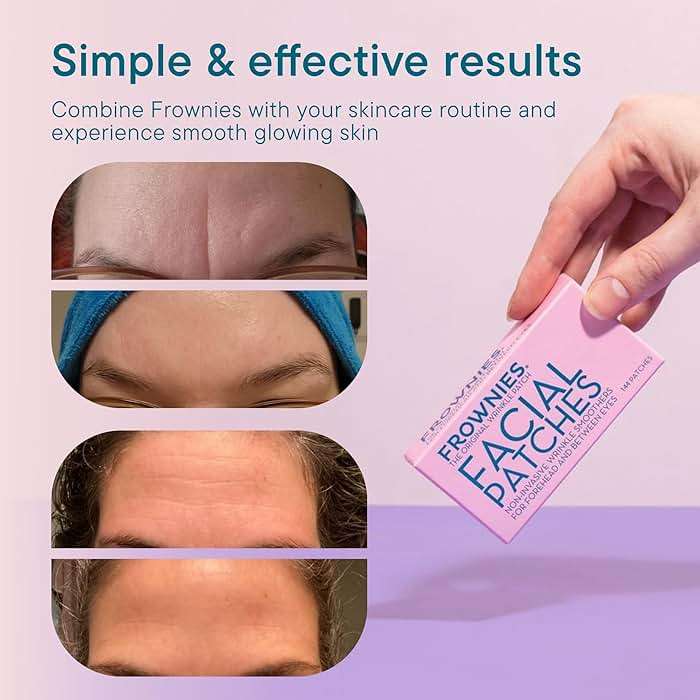 Frownies Forehead and Between the Eyes Wrinkle Patches - Hypoallergenic Facial Patches to Smooth & Soften Forehead Wrinkles & Eleven Lines - For Overnight Use, 144 Patches - Image 4