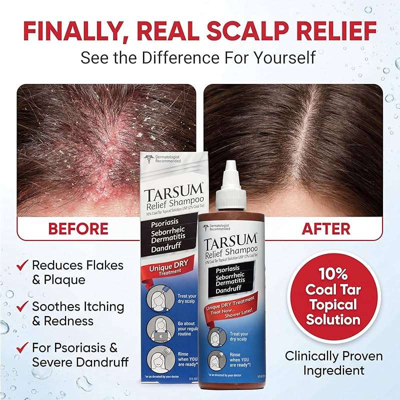 Tarsum Extra Strength Psoriasis Shampoo - Coal Tar Shampoo and Conditioner for Scalp Psoriasis, Seborrheic Dermatitis, Severe Dandruff, & Eczema - Exfoliating Relief for Flaky, & Itchy Scalp (4 oz) - Image 2