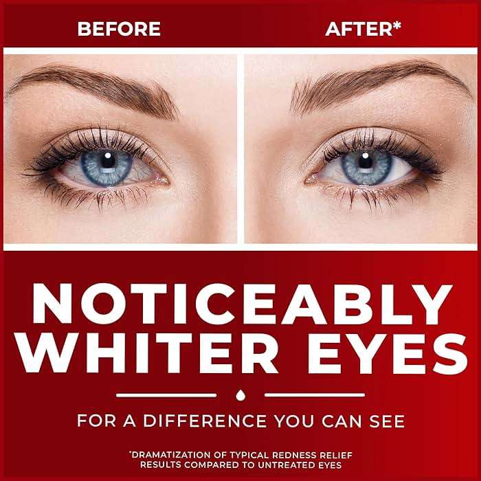 Clear Eyes | Maximum Redness Relief Eye Drops | 0.5 FL OZ - Image 4