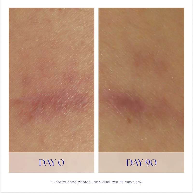 iS CLINICAL Super Serum Advance+, Anti-Aging Vitamin C Face Serum, reduces scaring and fine stretch marks - Image 4