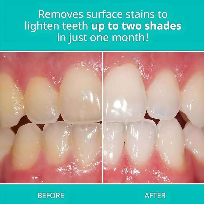 OpalescenceTeeth Whitening Toothpaste - Pack of 1 - Fluoride Oral Care - 4.7 Oz - Cool Mint - TP-5166-1 - Image 4