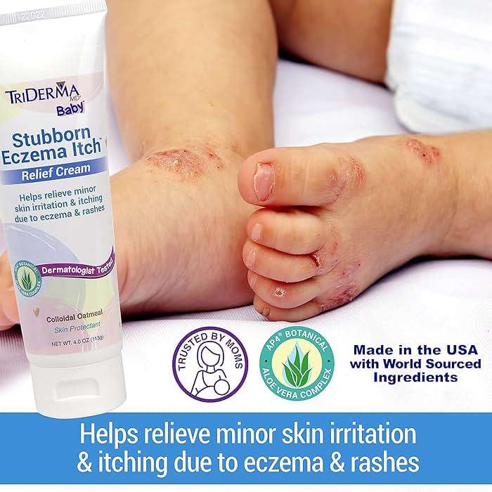 TriDerma Stubborn Eczema Itch Relief Cream (4 oz) - Image 3