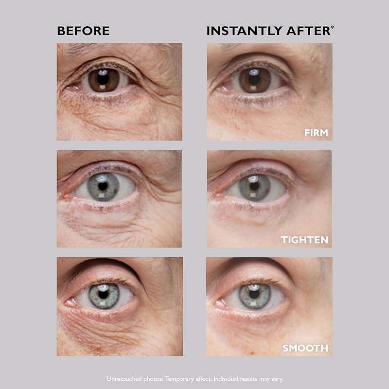 Peter Thomas Roth | Instant FIRMx® Eye Temporary Eye Tightener - Image 6