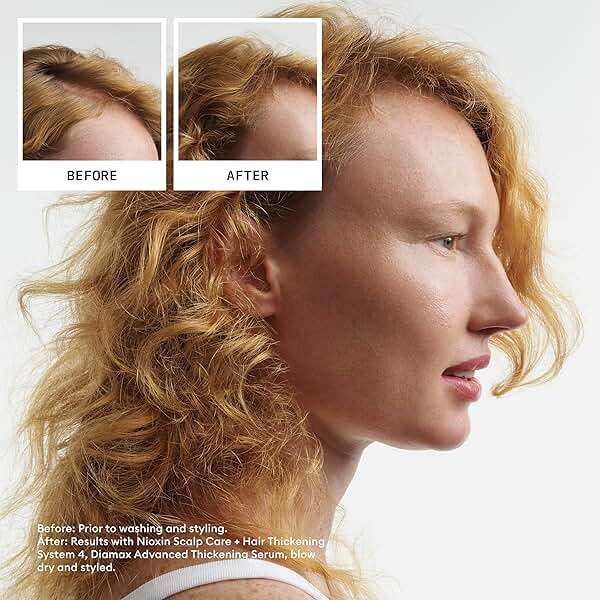Nioxin System 4 Scalp Care + Hair Thickening Leave-In Treatment for Colored, Dry & Damaged Hair with Progressed Thinning | Maintain Vibrant Color | Nourish & Boost Density with Niacinamide & Biotin - Image 3