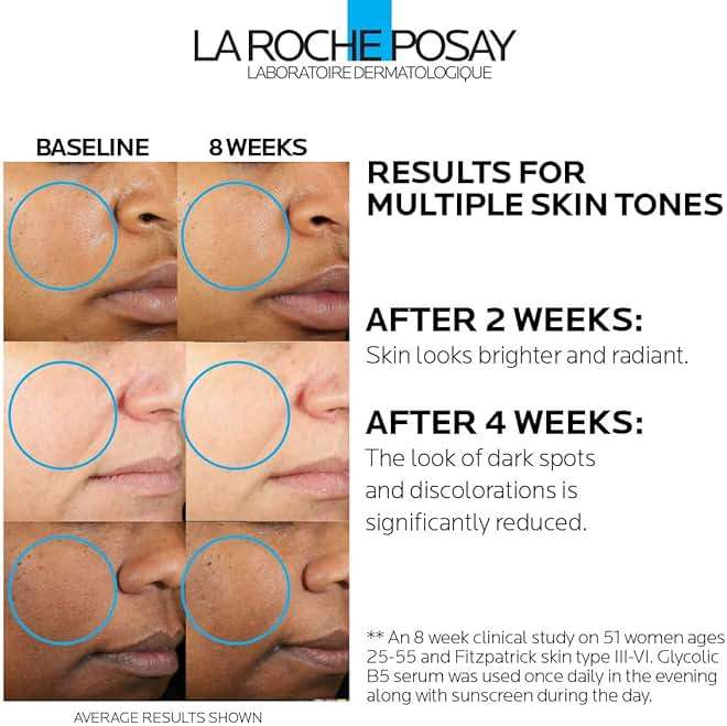 La Roche-Posay Glycolic Acid Serum with Tranexamic Acid, Kojic Acid and Vitamin B5, Reduces Dark Spots and Discoloration, Skin Tone Corrector to Brighten and Even Skin Tone - Image 2