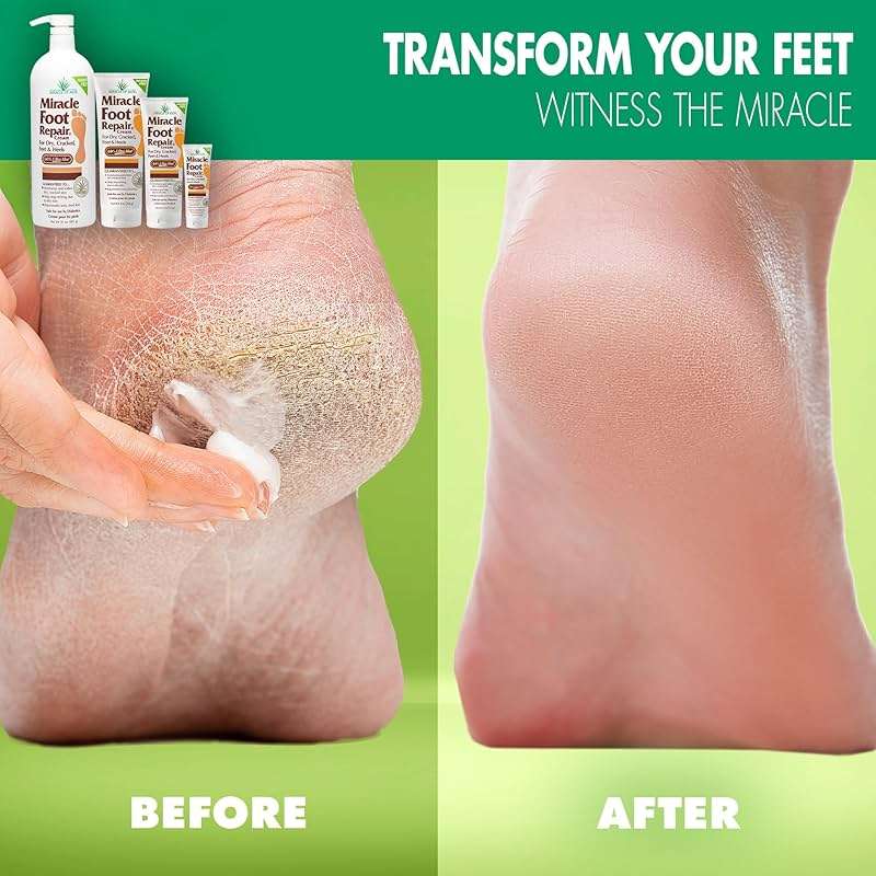 Miracle Foot Repair Cream, (1 oz / 3 Pack) Repairs Dry Cracked Heels and Feet, 60% Pure UltraAloe Moisturizes, Softens, and Repairs - Image 2