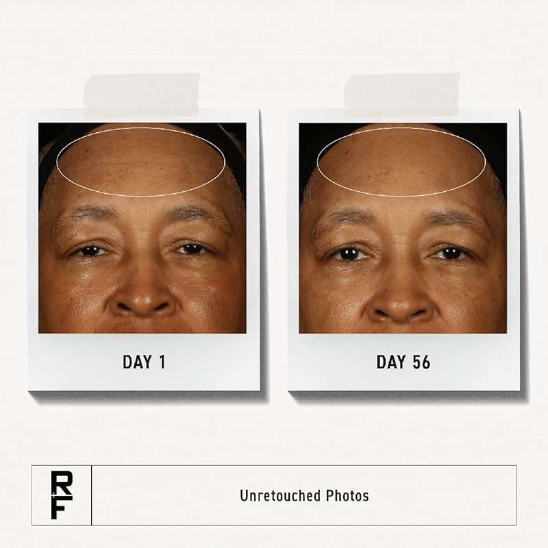 RODAN + FIELDS Redefine Overnight Restorative Cream | Step 3 PM | Anti Aging Face Moisturizer for Deep Wrinkles & Fine Lines | Firms & Tightens Skin | Night Face Cream | Glycolic Acid & Bakuchiol - Image 2