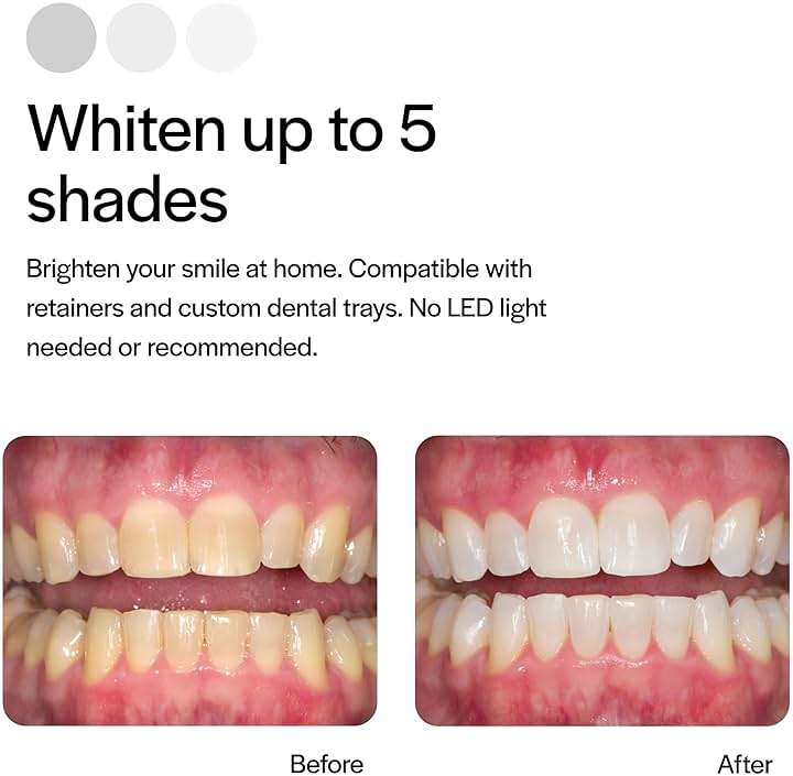 Opalescence 20% Teeth Whitening Refill Kit (4 Syringes) Carbamide Peroxide. Made by Ultradent, in Mint Flavor. Tooth Whitening Refill Syringes - B-5196-4 - Image 4