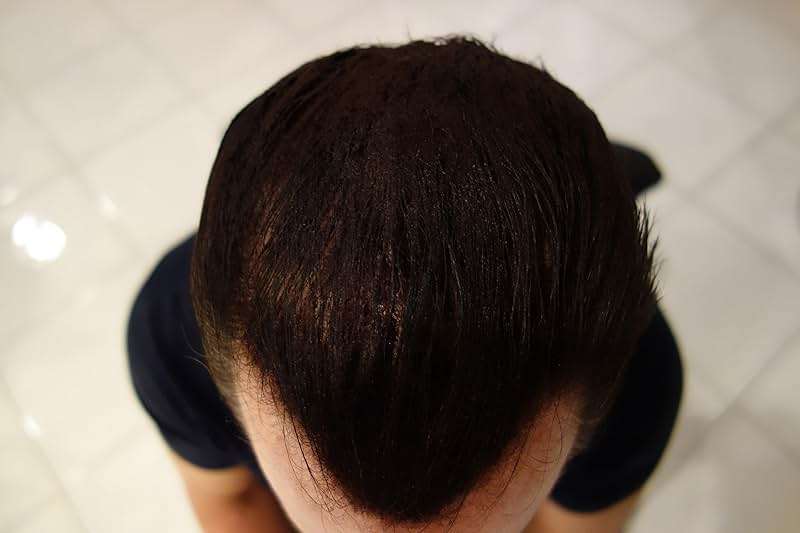 Finally Hair Fibers for Thinning Hair - 100% Undetectable Natural Formula - Completely Conceals Hair Loss in 15 Seconds - 25 Grams Refill Bag (Dark Brown) - Image 5