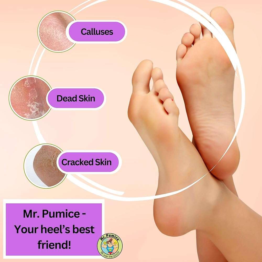 Mr. Pumice Purple PUMI Bar - Extra-Coarse Pumice Stone for Feet Callus Remover Pedicure Tools for Feet Foot Scrubber Skin Exfoliator Block, 4 Pack - Image 2
