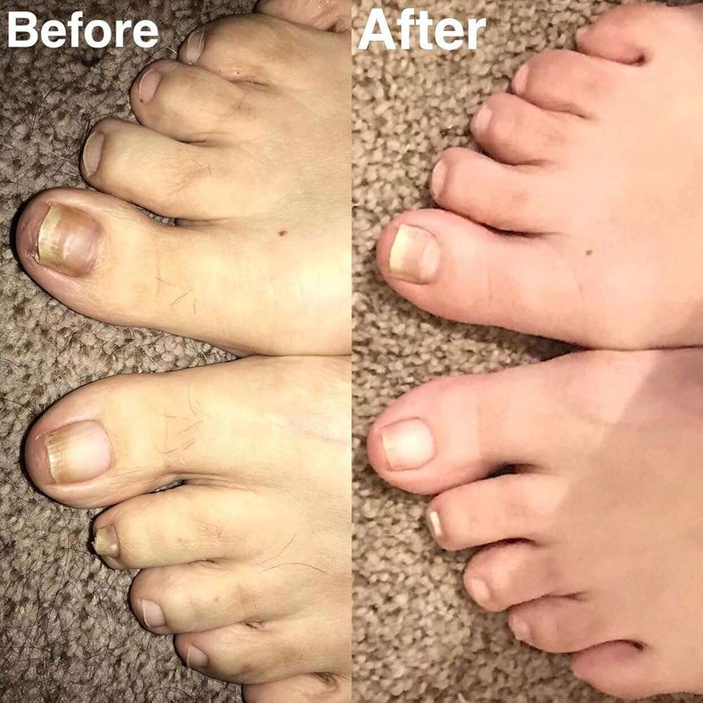 Probelle Natural Renewal Nail Oil, Nail Color Restoration, Clear Topical Solution, Restores Appearance of Discolored or Damaged Nails, .5 oz/ 15 ml - Image 7