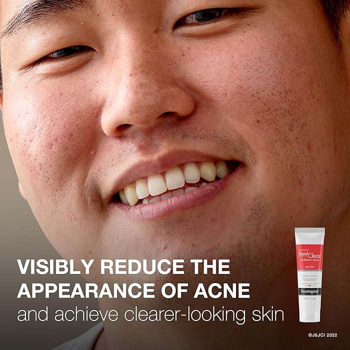 Neutrogena Rapid Clear Stubborn Acne Spot Treatment Gel, Maximum Strength 10% Benzoyl Peroxide Treatment Medication for Acne Prone Skin, Pimple Cream Reduces Size & Redness, 1 oz - Image 3