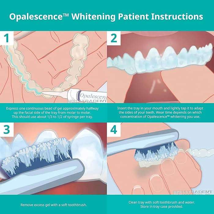 Opalescence 35% Gel Syringes Teeth Whitening - Refill Kit (4 Syringes Total) Carbamide Peroxide. Made by Ultradent, in Melon Flavor. Tooth Whitening Refill Syringes 5404-2 - Image 5
