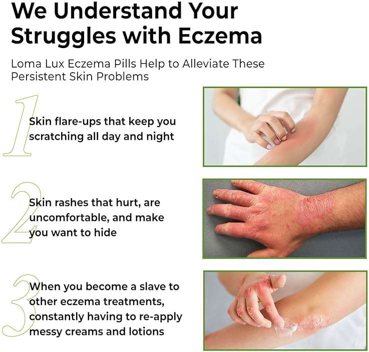 Loma Lux Eczema Pills – Natural Eczema Treatment Relief Remedy – Dermatologist Developed – 7 Minerals Clear & Prevent Severe Eczema Scaling, Rash, Anti Itch Skin Body Face for Adults, Kids, Toddlers - Image 4