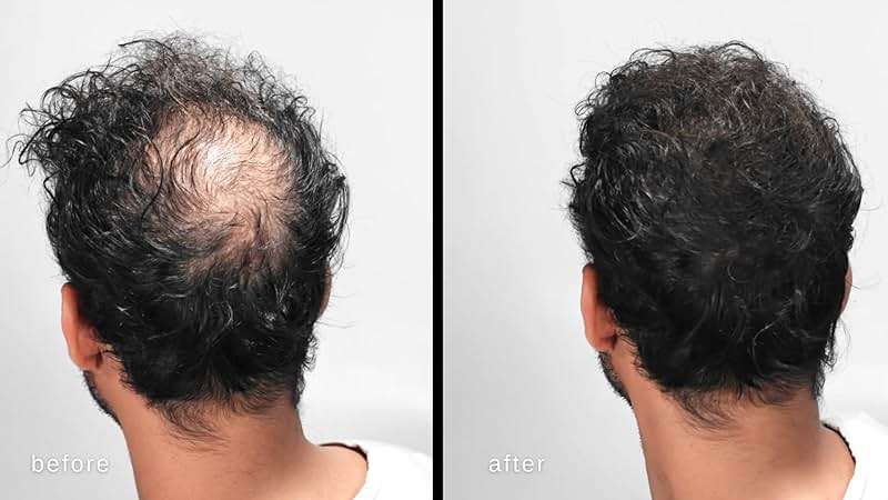 LUXE Hair Building Fibers - Thickening Fibers - CONFIDENCE IN A JAR – 2 + Months Supply – Hypoallergenic, Dermatologist Tested – Multiple Colors Available (Black) - Image 2