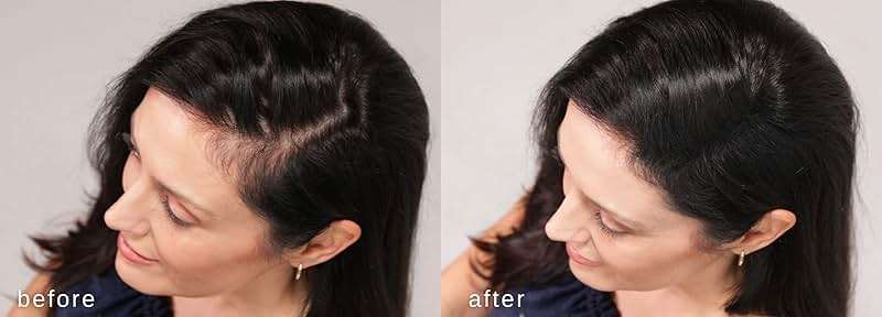 LUXE Hair Building Fibers - Thickening Fibers - CONFIDENCE IN A JAR – 2 + Months Supply – Hypoallergenic, Dermatologist Tested – Multiple Colors Available (Black) - Image 3