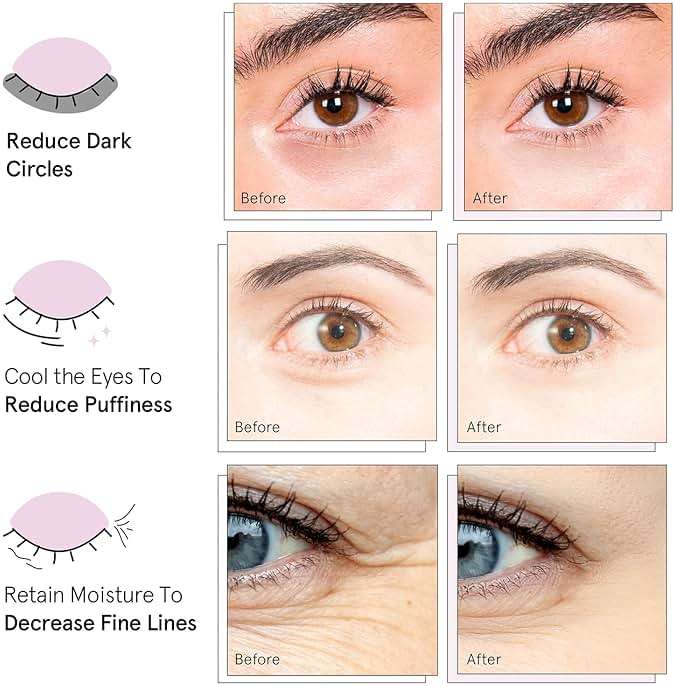 Grace & Stella Under Eye Mask for Dark Circles, Puffy Eyes, Undereye Bags, Wrinkles - Gel Under Eye Patches - Vegan (24 Pairs, Gold) - Image 3