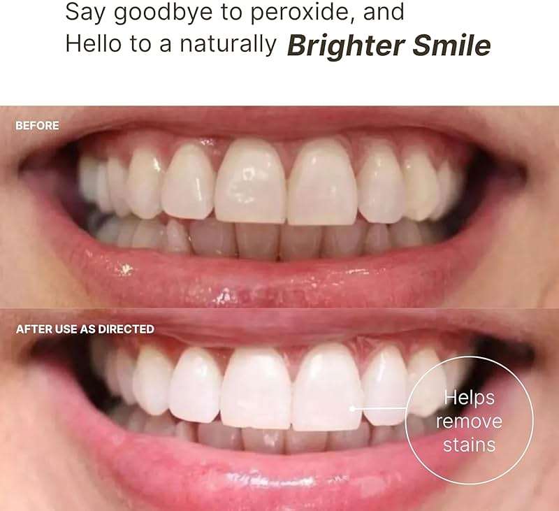 Nu Skin AP 24 Whitening Fluoride Toothpaste | AP 24 Blend | Vanilla Mint Flavor | Brightens Teeth | Removes Surface Stains | Prevents Dental Cavities & Plaque | Enamel-Safe | 4 oz | 1 Pack - Image 2