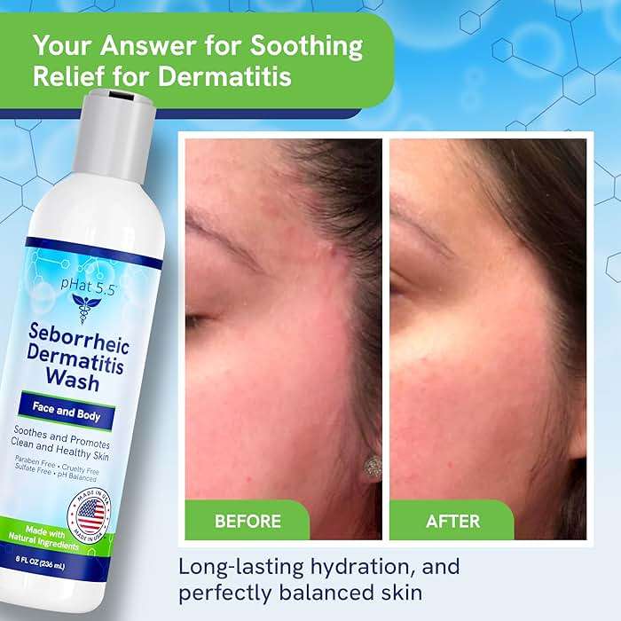 Seborrheic & Atopic Dermatitis Gentle Face Wash with Manuka Honey - Natural & Organic Face Cleanser & Body Wash For Sensitive Skin - Hypoallergenic, Paraben Free & Sulfate Free Acne Face Wash (8oz) - Image 6