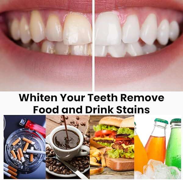 Natural Teeth Whitening Strips for Sensitive Teeth, Peroxide Free White Strips with Baking Soda, Enamel Safe Tooth Whitener, Vegan No Bleach Formula, Mint Flavor 14 Day Kit, 28 Count - Image 4