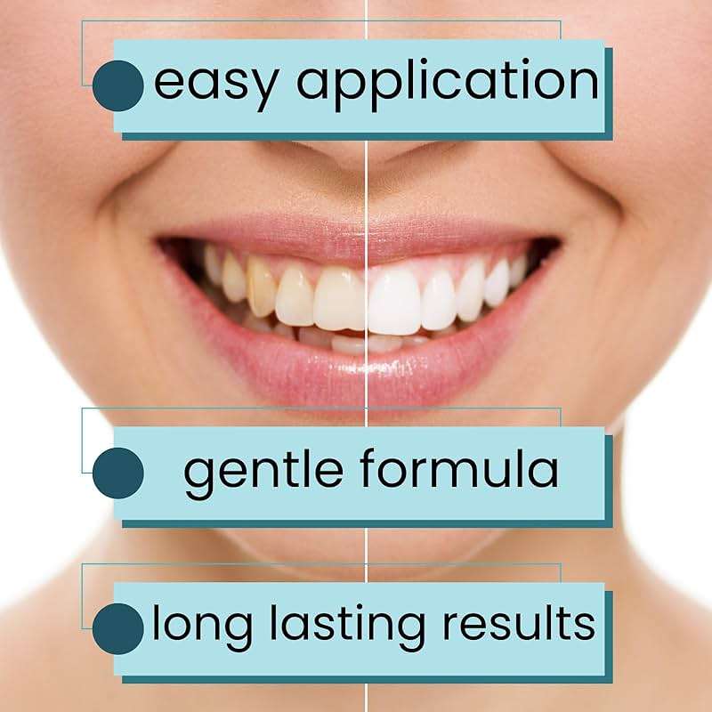 Natural Teeth Whitening Strips for Sensitive Teeth, Peroxide Free White Strips with Baking Soda, Enamel Safe Tooth Whitener, Vegan No Bleach Formula, Mint Flavor 14 Day Kit, 28 Count - Image 9