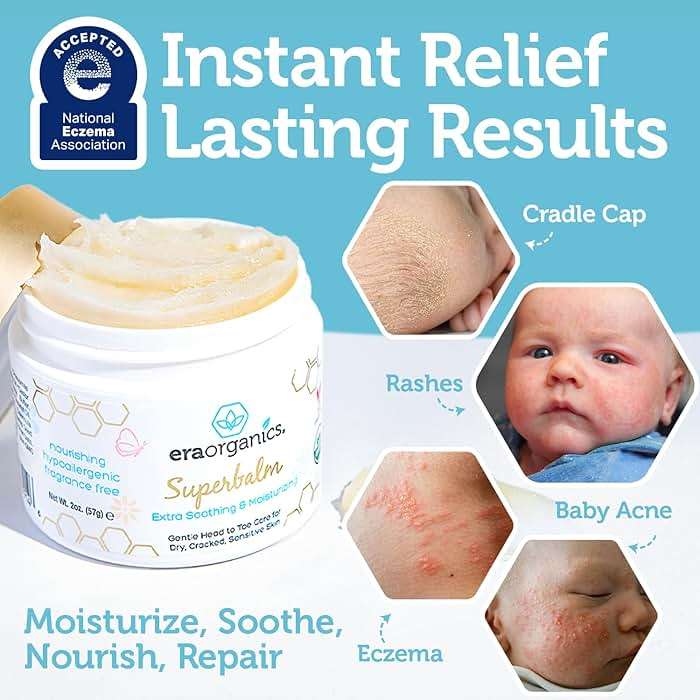 Era Organics Healing Ointment for Babies - USDA Certified Organic Natural Moisturizer Gentle on Sensitive Skin Prone To Baby Eczema, Cradle Cap (Infant Seborrheic Dermatitis), Rashes, Hives 2oz - Image 3