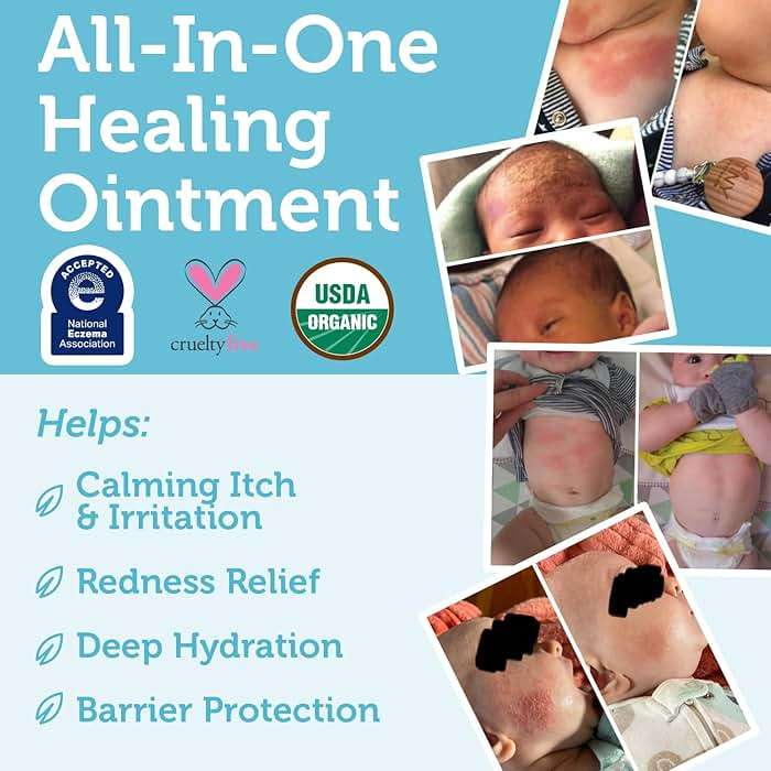 Era Organics Healing Ointment for Babies - USDA Certified Organic Natural Moisturizer Gentle on Sensitive Skin Prone To Baby Eczema, Cradle Cap (Infant Seborrheic Dermatitis), Rashes, Hives 2oz - Image 5