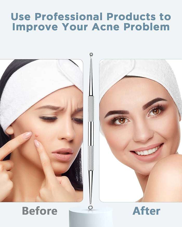BESTOPE Blackhead Remover Blackhead Removal Pimple Comedone Extractor Tool - Treatment for Blemish Whitehead Popping Zit Removing with Metal Case (Silver) - Image 2