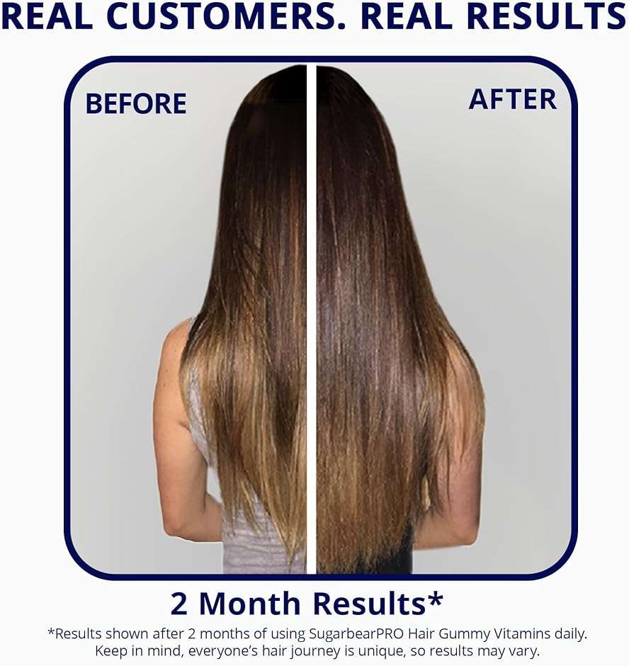 SugarbearPRO Hair Vitamin Gummy 2 Month Supply Extra Strength Biotin 6000mcg, Growth for Men & Women, Vegan Vitamin B12, MSM, Inositol, Omega 3, Elderberry, Certified Kosher, Halal, Cruelty-Free - Image 7
