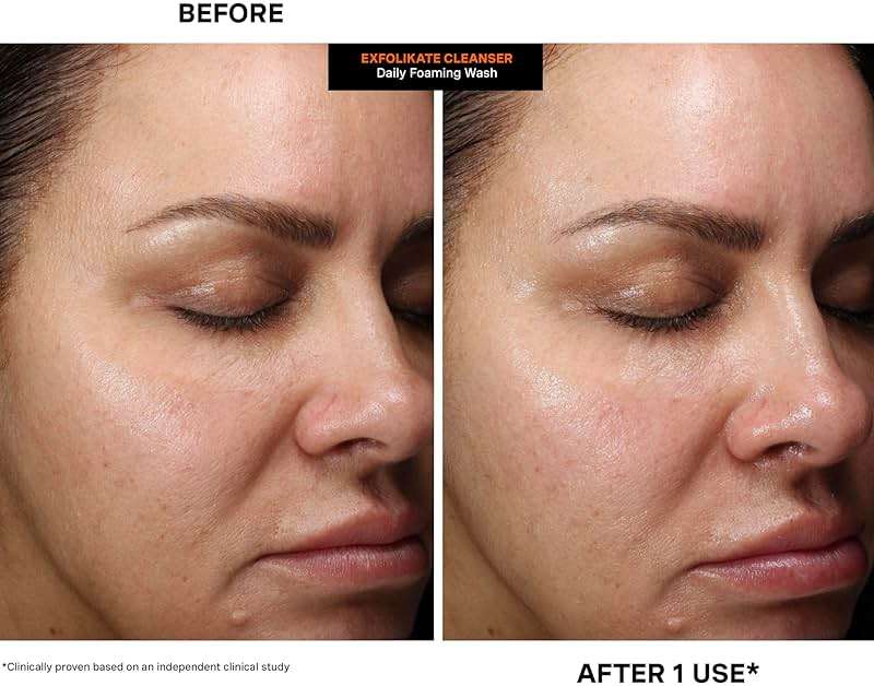 Kate Somerville ExfoliKate Cleanser – Daily Exfoliating Foaming Face Wash – Clinically Formulated Glycolic Acid and Lactic Acid Gentle Facial Scrub - Image 7