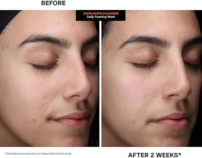 Kate Somerville ExfoliKate Cleanser – Daily Exfoliating Foaming Face Wash – Clinically Formulated Glycolic Acid and Lactic Acid Gentle Facial Scrub - Image 9