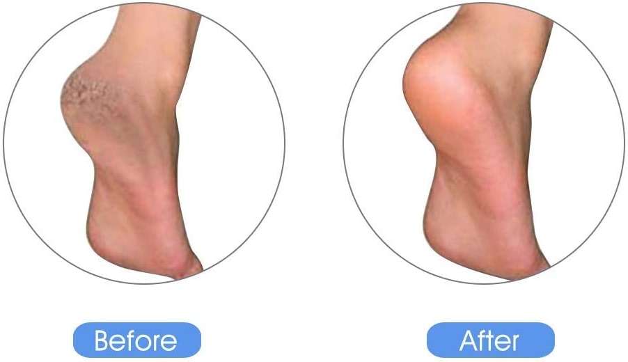 KuuCare Pumice Stone for Feet, Natural Earth Lava Pumice Stone - Foot Callus Remover for Feet Heels, Pedicure Exfoliator for Dead Skin, Hard Skin and Foot Scrubber - Image 5