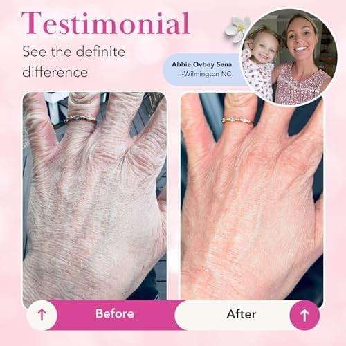 Theraplex Clear Emollient Lotion (8 oz) - No Parabens or Preservatives, Noncomedogenic and Hypoallergenic, Fragrance Free, Dermatologist recommended (6 Pack Pour) - Image 4