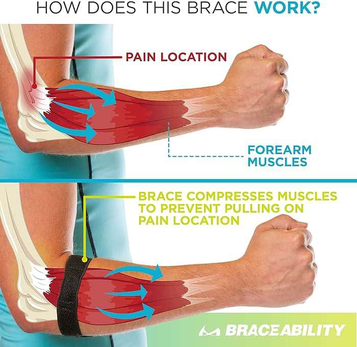 BraceAbility Epicondylitis Brace | Elbow Strap for Medial/Lateral Epicondyle Pain and Tendonitis Arm Compression Support Band for Men or Women (One Size Fits Most) - Image 4