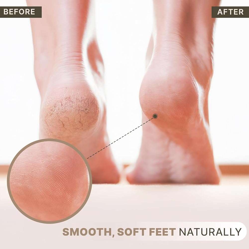 Pumice Stone for Feet - Natural Lava Stone Foot Exfoliator, Callus Remove for Feet, Hands & Dead Skin, Foot Scrubber for Pedicure & Cracked Heels, Strong & Durable Design for Smooth & Soft Feets - Image 4