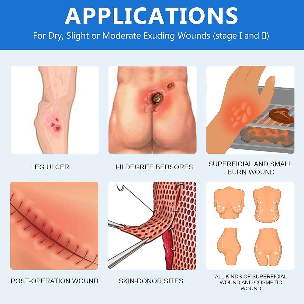 LotFancy Sacral Hydrocolloid Dressing, 6”x7”, Pack of 5, Sterile Thin Bordered Hydrocolloid Bandages, Sacrum Wound Gel Patches for Fast Healing, Water-Resistant, Individually Packed - Image 5