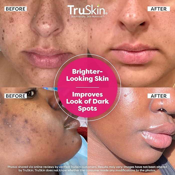TruSkin Vitamin C Super Serum for Face - Five Skin Benefits in One Serum with Vitamin C, Retinol, Niacinamide, Hyaluronic Acid & Squalane - Brighten, Firm & Smooth the Look of Skin - 1 fl oz - Image 2