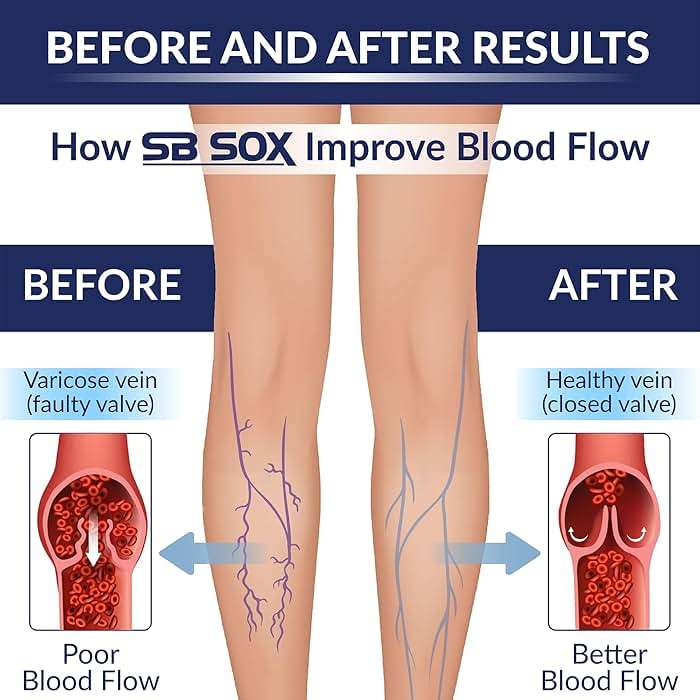 SB SOX Compression Socks for Men & Women (20-30mmHg) – Best Compression Socks for Flying, Medical, Sports, Wide Calf Fit, and Daily Wear - Image 3