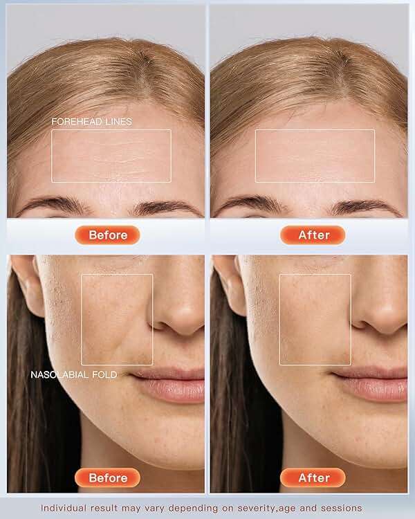 NEWKEY 4D LED Red Light Therapy Mask for Face Skin Glowing,630nm Led Light Therapy Face Mask Anti Wrinkle, Blue Light Therapy Face Mask for Acne,Home use,450 LED Chips,Birthday gift,Plug in - Image 3