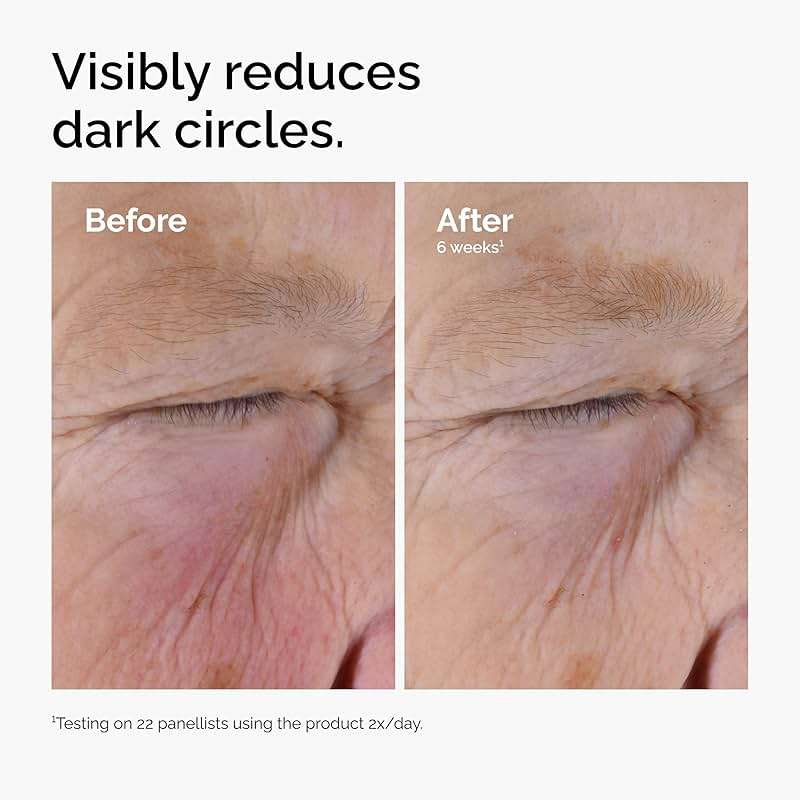The Ordinary Caffeine Solution 5% + EGCG Eye Serum, Depuffing Eye Serum for Dark Circles and Tired Eyes - Image 6