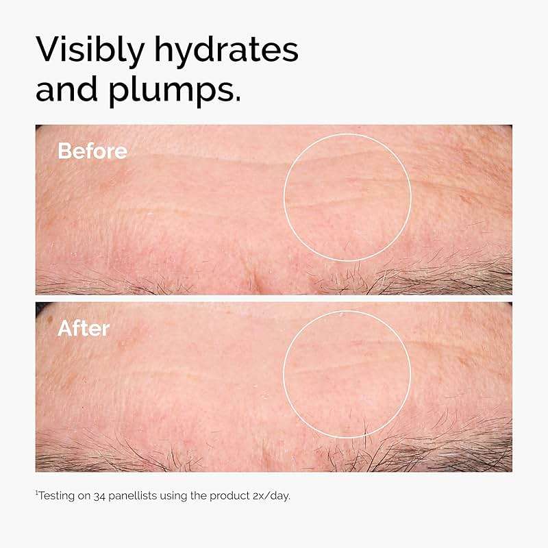 The Ordinary Hyaluronic Acid 2% + B5 (with Ceramides), Multi-Depth Hydration Serum for Plumper, Smoother Skin - Image 2