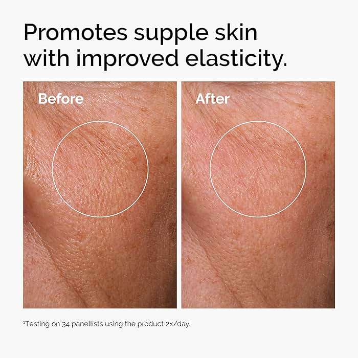 The Ordinary Hyaluronic Acid 2% + B5 (with Ceramides), Multi-Depth Hydration Serum for Plumper, Smoother Skin - Image 3
