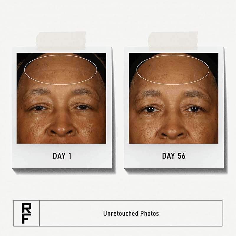 Rodan + Fields Redefine Pore Minimizing Toner | 4.2 fl oz | Deep Exfoliating Cleanser | Visibly Reduces Blackheads | Formulated with Fruit Acids - Image 2