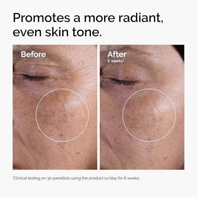 The Ordinary Glycolic Acid 7% Exfoliating Toner, Brightening and Smoothing Daily Toner for More Even-Looking Skin Tone - Image 2