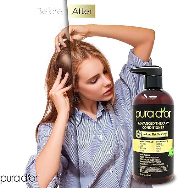 PURA D'OR Advanced Therapy Conditioner (16oz) For Increased Moisture, Strength, Volume & Texture, No Sulfates, Contains Argan Oil & Biotin, All Hair Types, Men & Women (Packaging May Vary) - Image 3