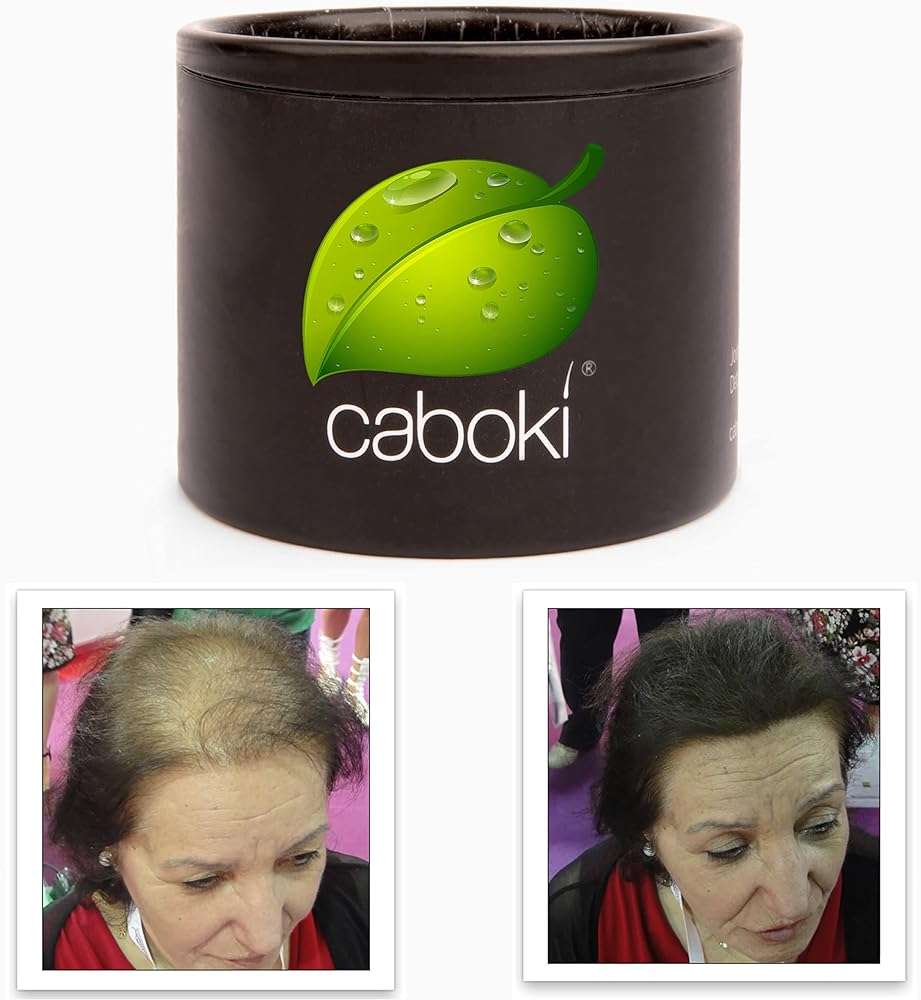 Caboki Hair Fibers for Thinning Hair – Natural Plant-Based Bald Spot Cover Up for Men and Women – Instantly Thicker Fuller Looking Scalp – Clean Ingredients – Trial Size, 10-Day Supply, Dark Brown - Image 1