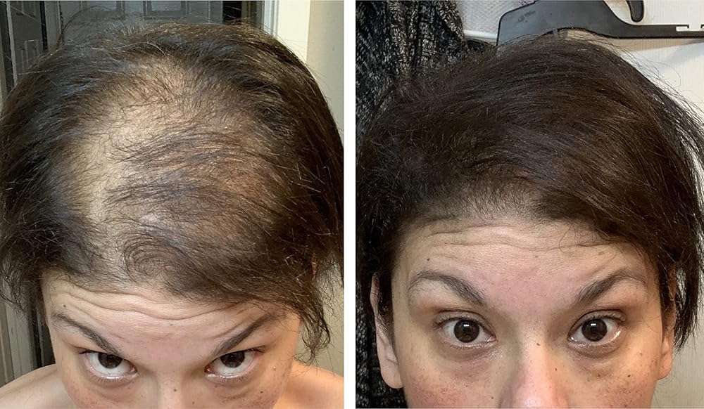 Caboki Hair Fibers for Thinning Hair – Natural Plant-Based Bald Spot Cover Up for Men and Women – Instantly Thicker Fuller Looking Scalp – Clean Ingredients – Trial Size, 10-Day Supply, Dark Brown - Image 5