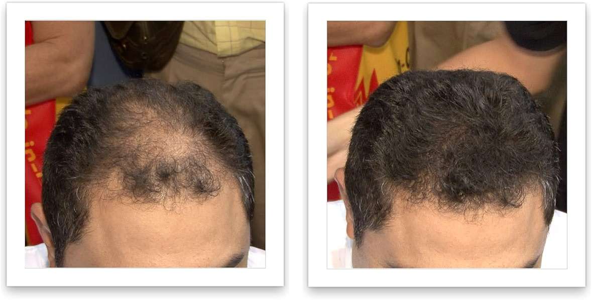 Caboki Hair Fibers for Thinning Hair – Natural Plant-Based Bald Spot Cover Up for Men and Women – Instantly Thicker Fuller Looking Scalp – Clean Ingredients – Trial Size, 10-Day Supply, Dark Brown - Image 6